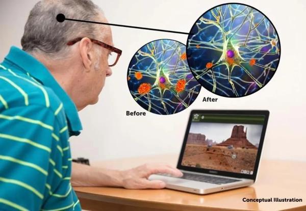 آیا بازی های فکری می توانند آلزایمر را مهار نمایند؟ آنالیز علمی BrainHQ و کاهش پروتئین آمیلوئید